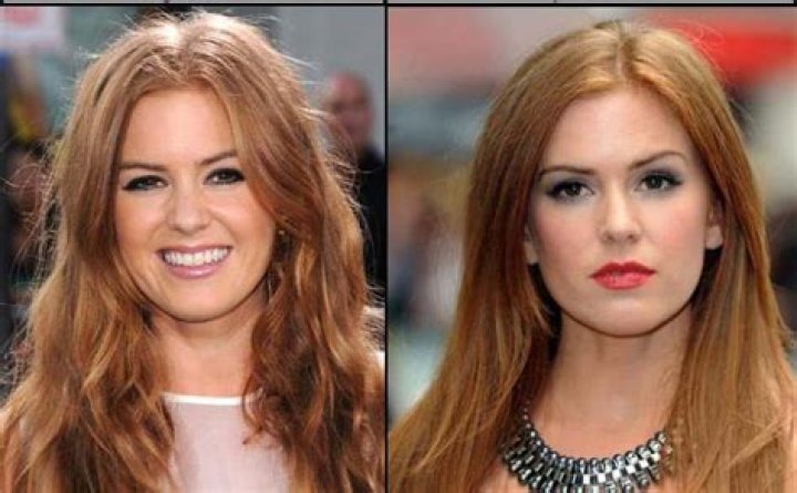Isla Fisher Plastic Surgery Before and After