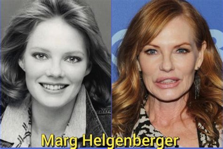 Marg Helgenberger Plastic Surgery Before and After