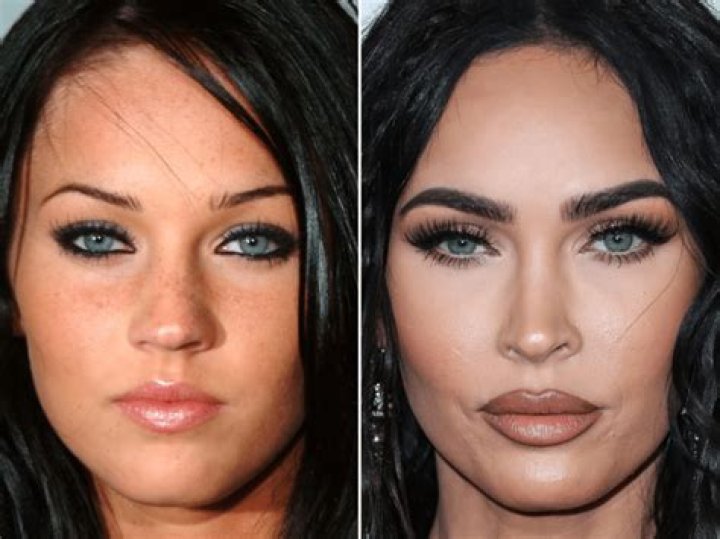 Megan Fox Plastic Surgery: How Her Cosmetic Procedures Transformed Her Appearance