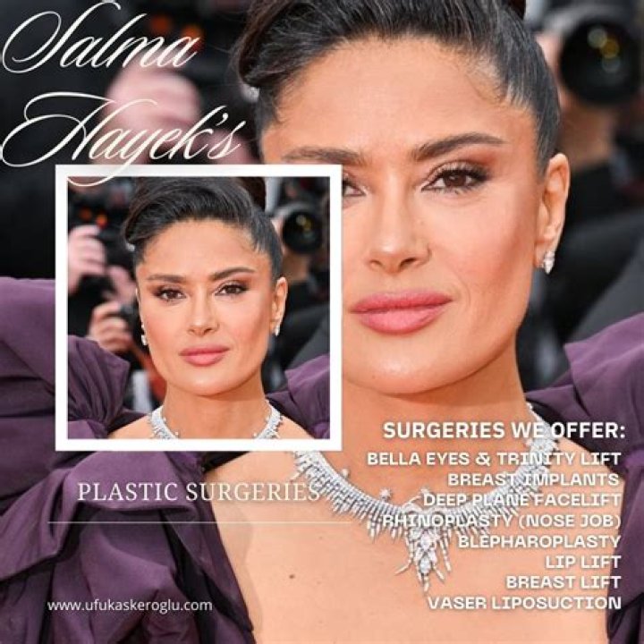 Salma Hayek Plastic Surgery: Botox, Breast Augmentations and What Not?