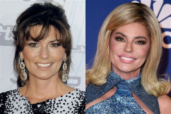 Shania Twain Plastic Surgery: Her Approach of Embracing or Altering Herself?